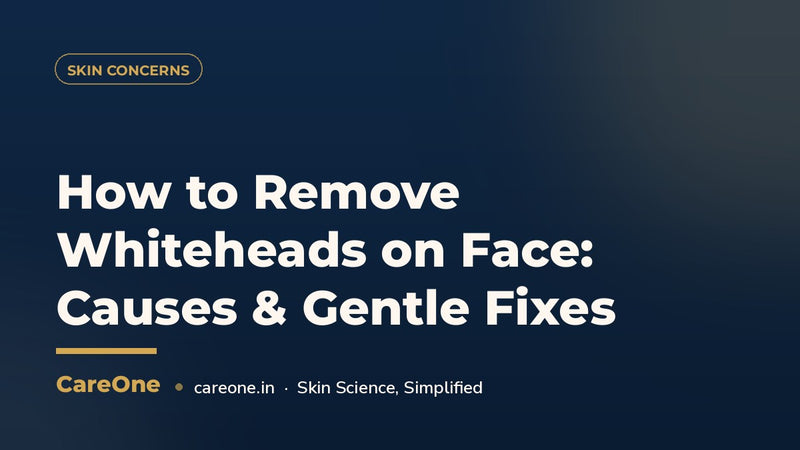 How to Remove Whiteheads on Face: Causes & Gentle Fixes (India 2026)