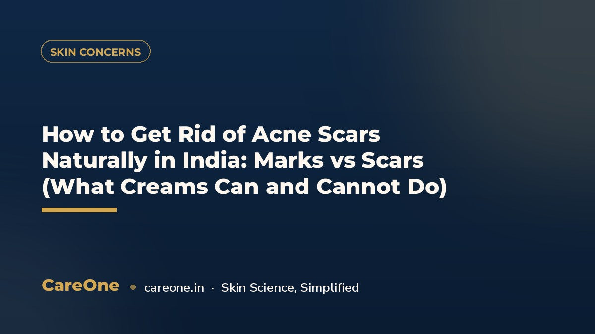 How to Get Rid of Acne Scars Naturally in India: Marks vs Scars (What Creams Can and Cannot Do) — CareOne blog cover