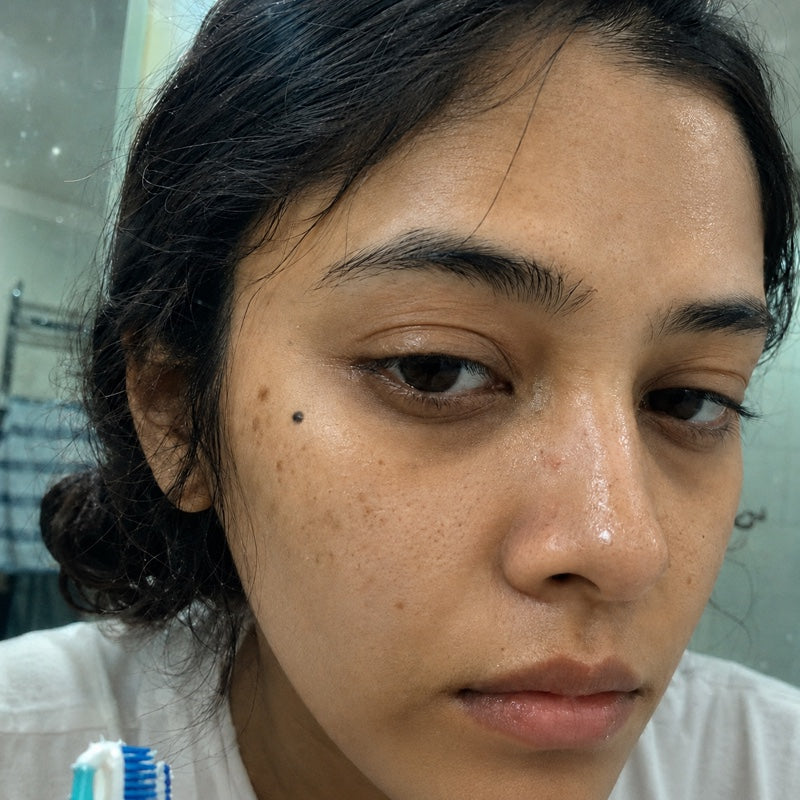 Day 1 — baseline skin